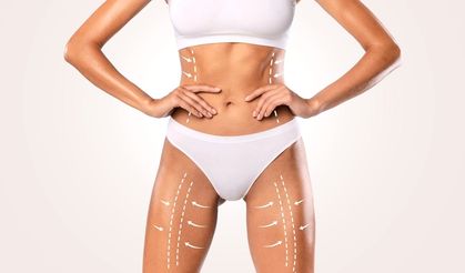 Liposuction ile Kaç Kilo Verilir?